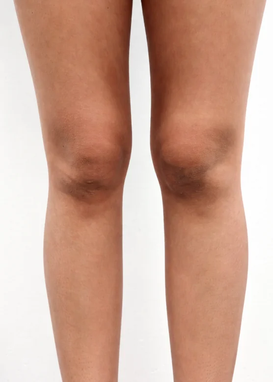 Close view of knees with darker skin