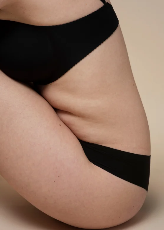 Close view of loose skin on a woman's thighs