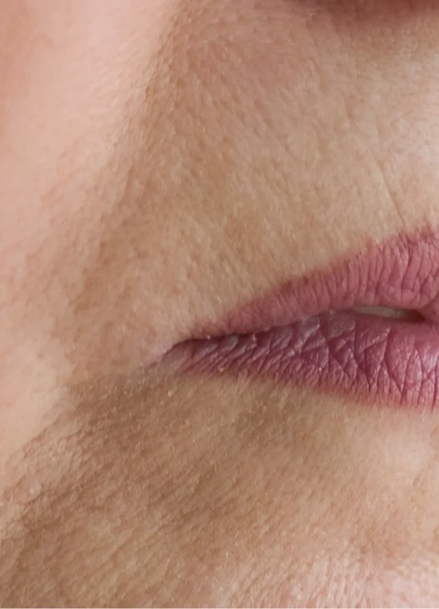 Close view of downturned mouth corners