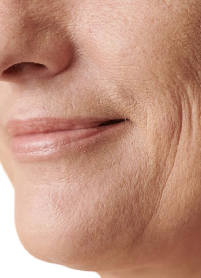 Close view of skin along a woman's lower face
