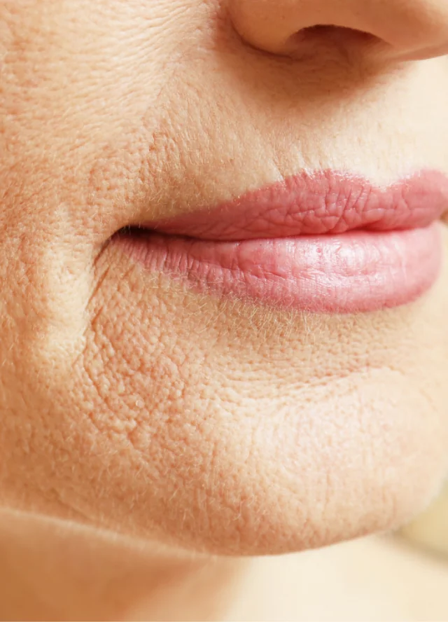 Close view of fine lines around a woman's lips