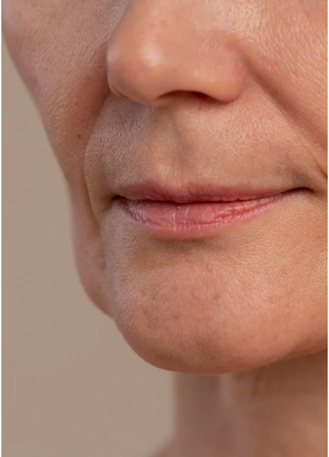Close view of a woman's cheek and mouth