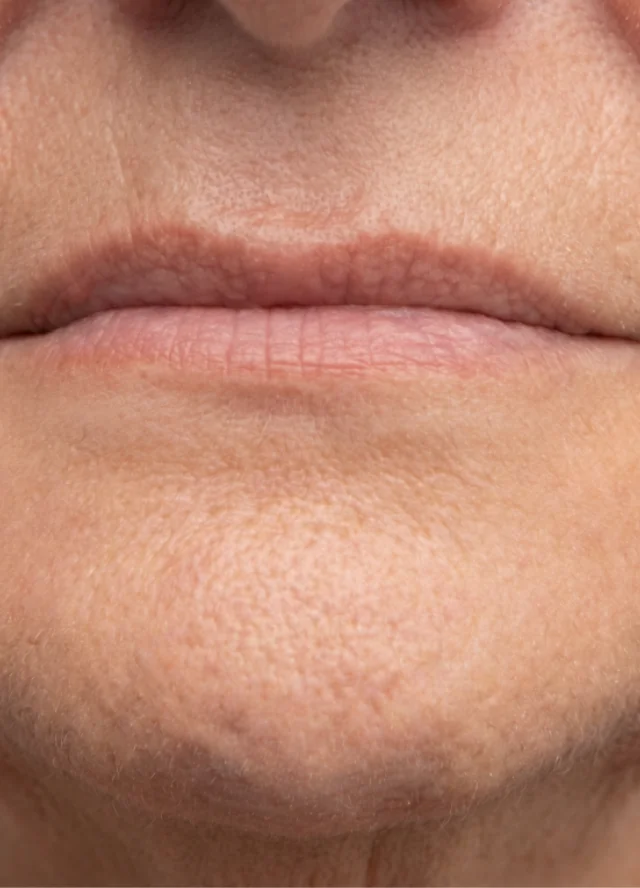 Close view of uneven lips