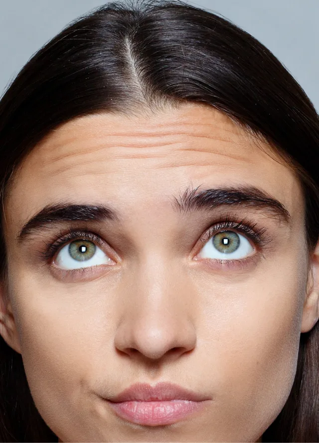 Woman with forehead lines raising her brows