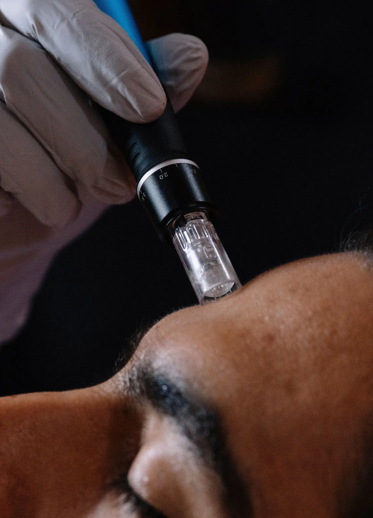Man receiving a facial skin treatment