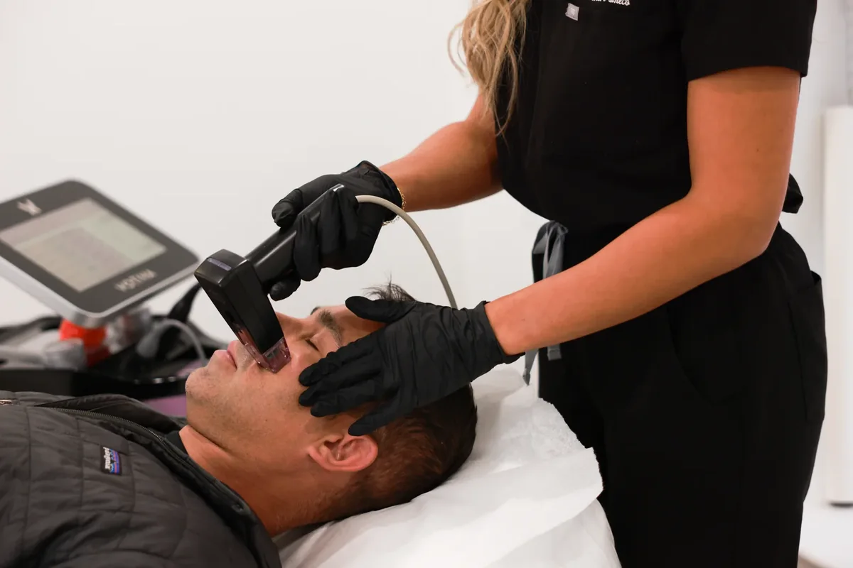 Male patient receiving RF microneedling at Advanced Aesthetics