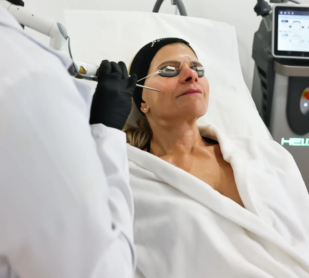 Patient receiving a CO2 laser facial treatment with eye protection at Advanced Aesthetics
