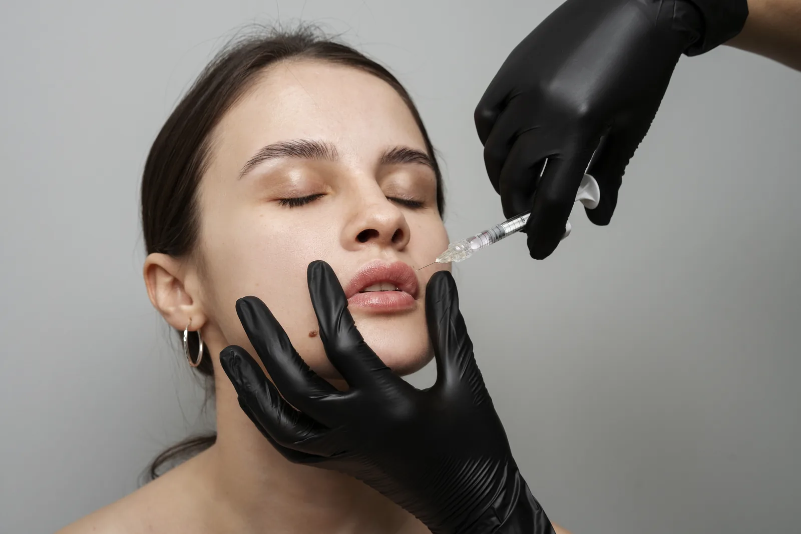Lip filler injection at Advanced Aesthetics