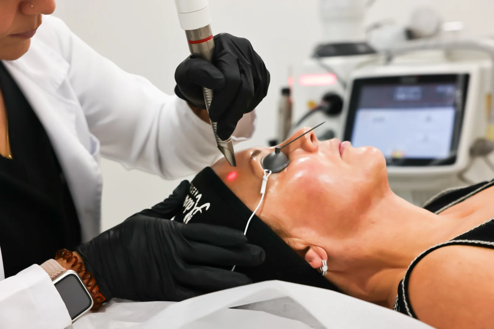 Fotona laser facial treatment with eye protection at Advanced Aesthetics