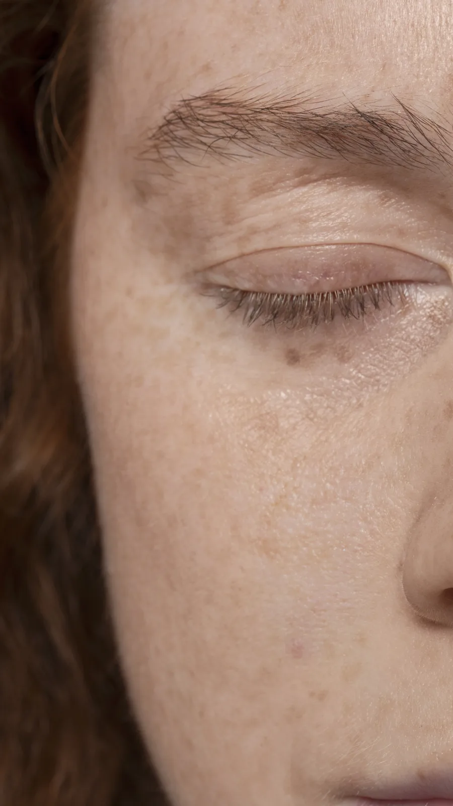 Close-up of skin texture and pores before microneedling