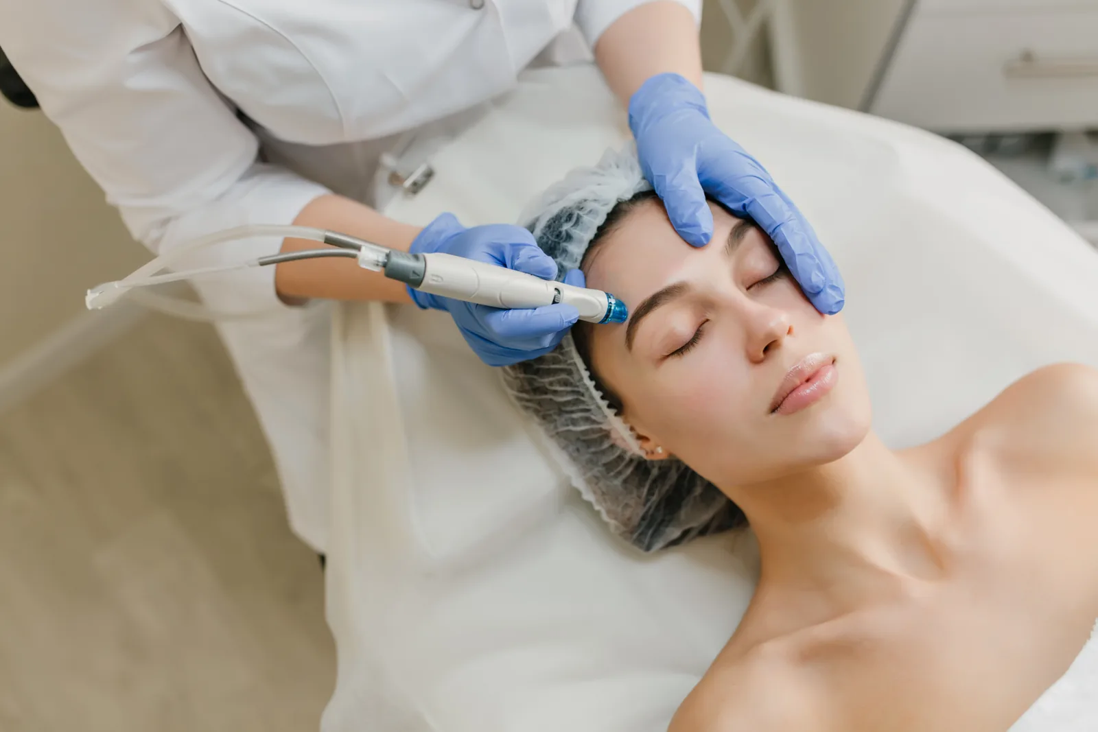 Microneedling pen treatment on the cheek at Advanced Aesthetics, Medford and Braintree MA